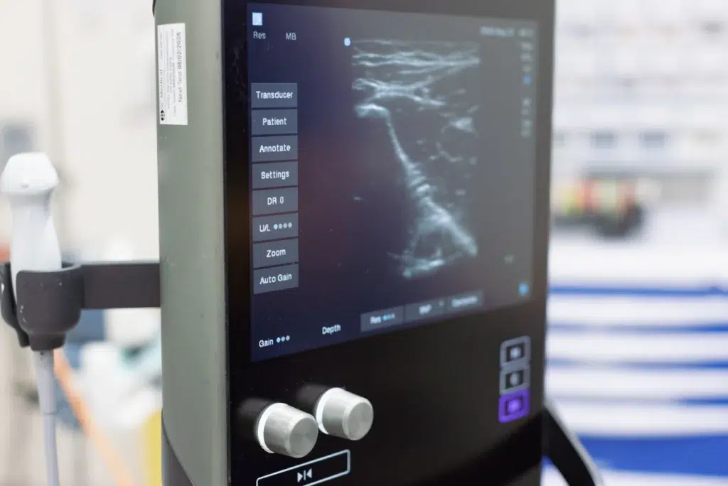 Types of Anaesthesia